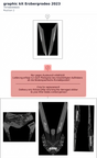 Diagram preview: graphic kit Erzbergrodeo 2023 (79708099600)